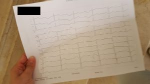 Den Ausdruck des EKGs nehmt ihr dann mit, der kommt in eure Krankenhaus-Akte.