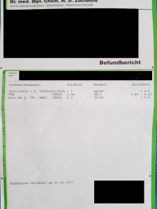 Blutbild mit Schilddrüsen-Werten, TSH basal, Calcitonin, Auto-AK, MAK, TPO