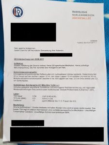 Vergrößerte Schilddrüse, früher als Kropf bezeichnet, mit kalten Knoten.