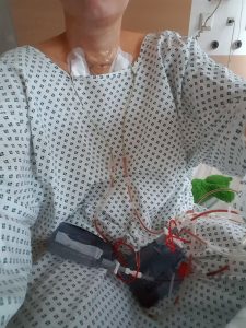 In die Beutel läuft das Blut und die Wundflüssigkeit ab.